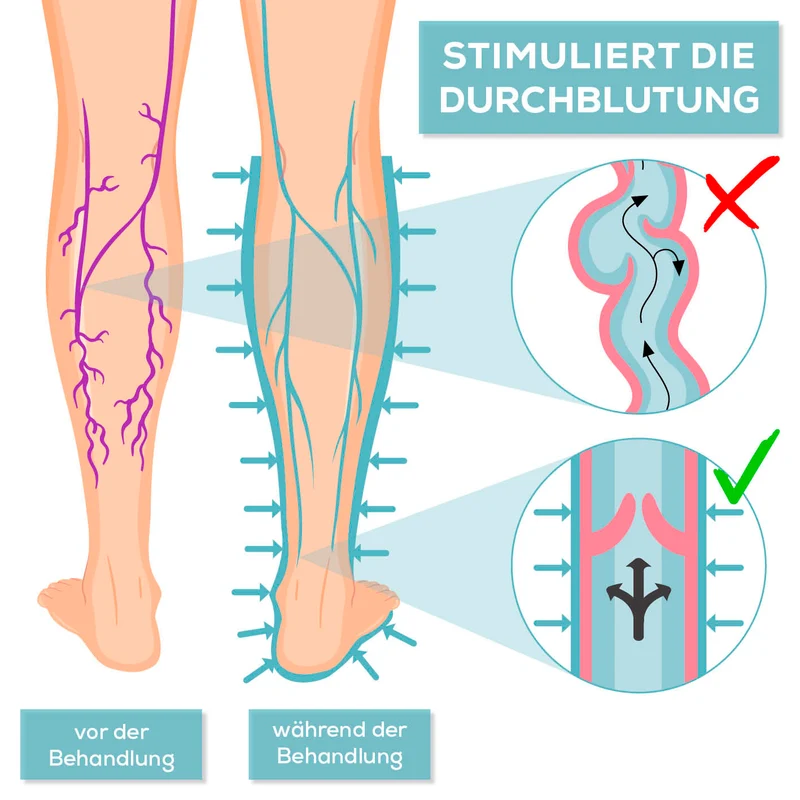 Therapiegerät VenenWalker Basic - Medizinprodukt